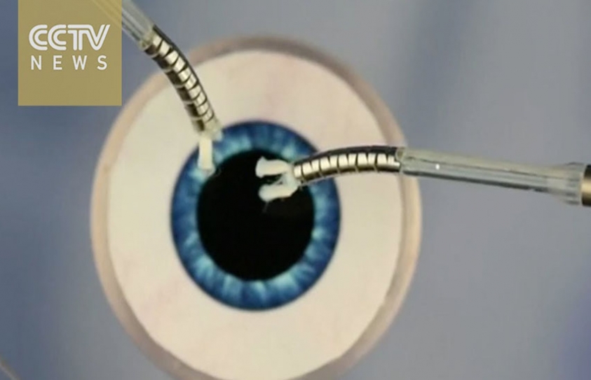 Watch If You Dare: This Tentacled Robot Will Perform Microsurgery on Your Eyes