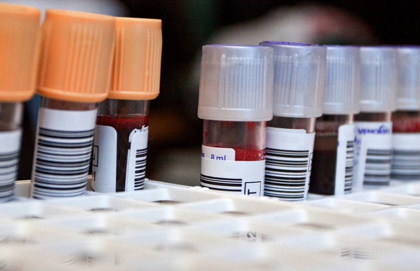  Common Blood Tests Can Help Predict Chronic Disease Risk  