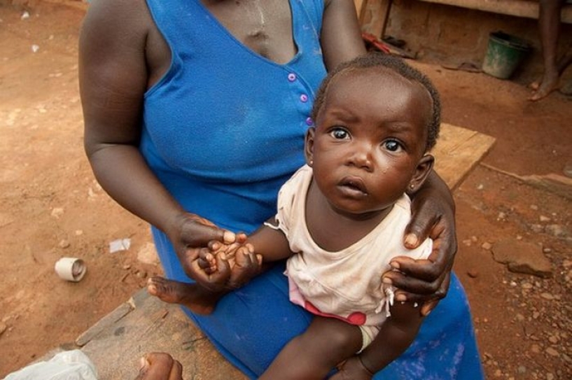 Safe babies for HIV-infected mothers