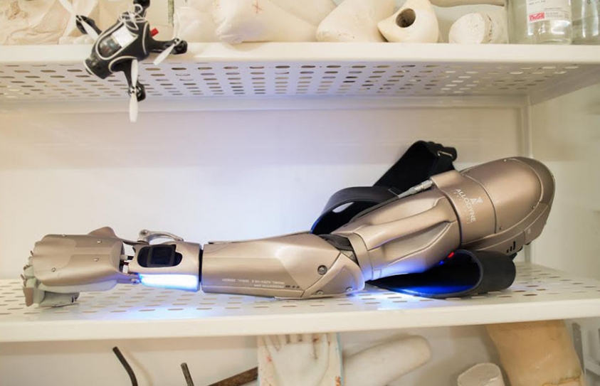 'Metal Gear Solid'-Inspired Prosthetic Limb Sends Email, Charges Phones