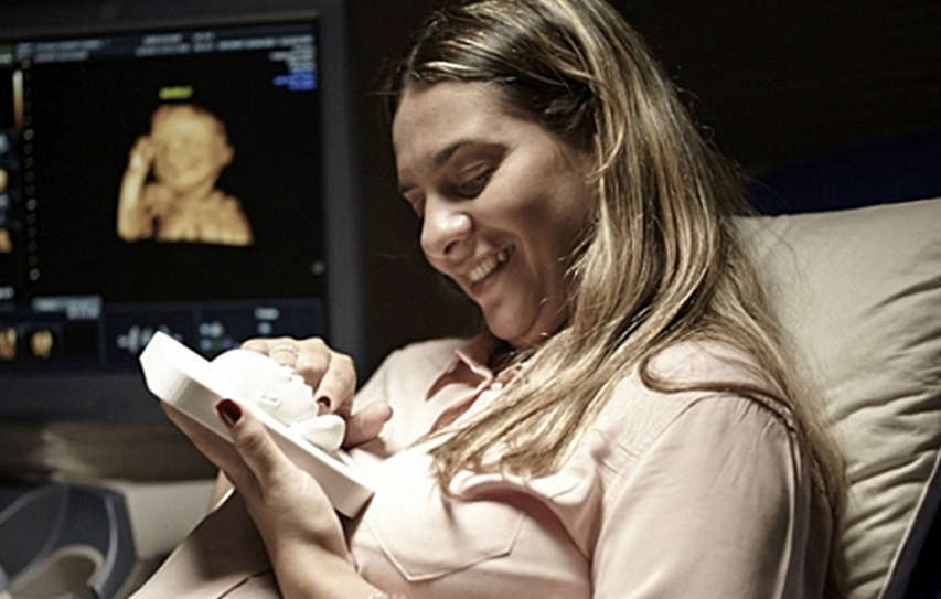 Blind Mom Sees Unborn Baby Through 3D Printed Ultrasound 