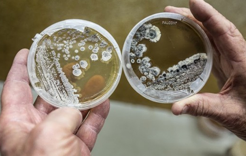 How Worried Should We Be About The 'Nightmare Bacteria' Making Headlines?