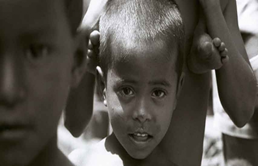 Child-Health Spending Soars, But 40 Million Indian Children Stunted