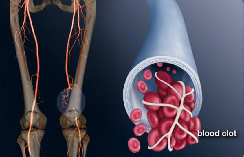Now just pop a pill to stop blood clots