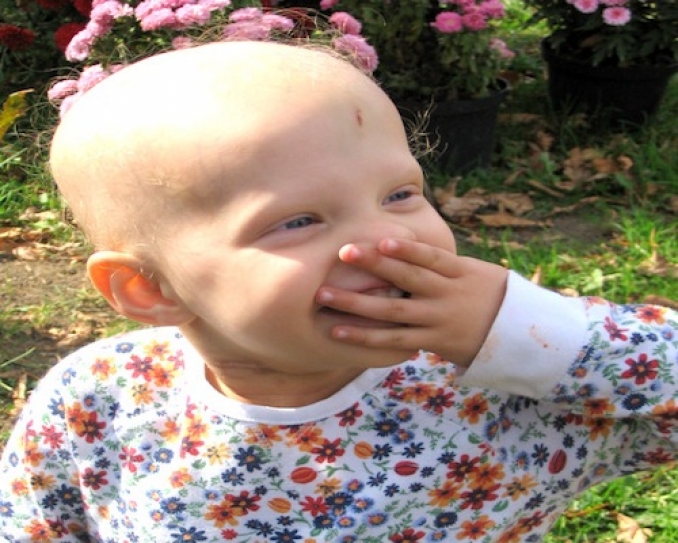 Childhood cancer’s new conundrum