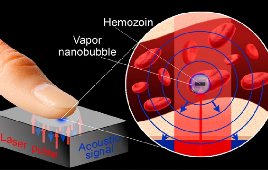 A New Test for Malaria, No Blood Required