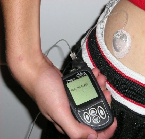 50% of Diabetics Do Not Adhere To Insulin Treatment Practices