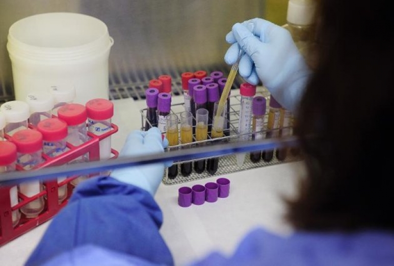 HIV Drug Offers Long-Lasting Protection Against Infection