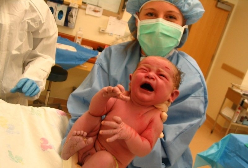 Hospitals Safer Than Homes for Births