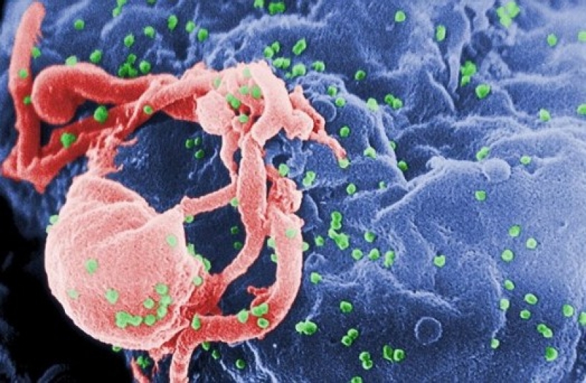 AIDS/HIV Fast Facts