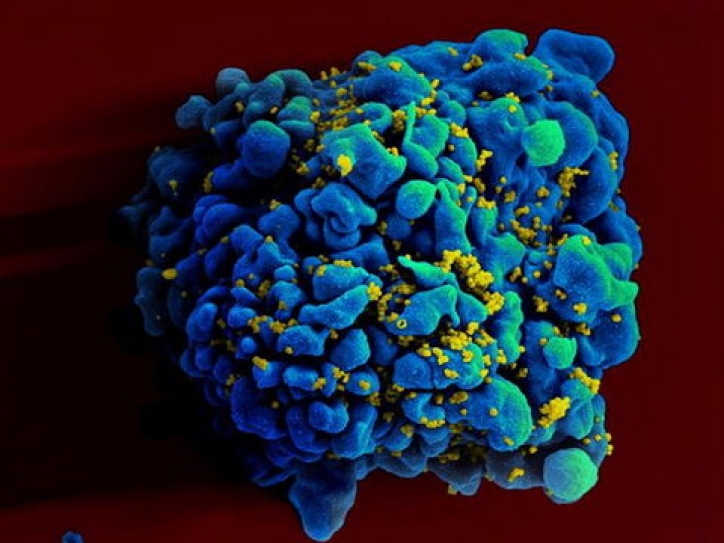 HIV must be revealed to partners
