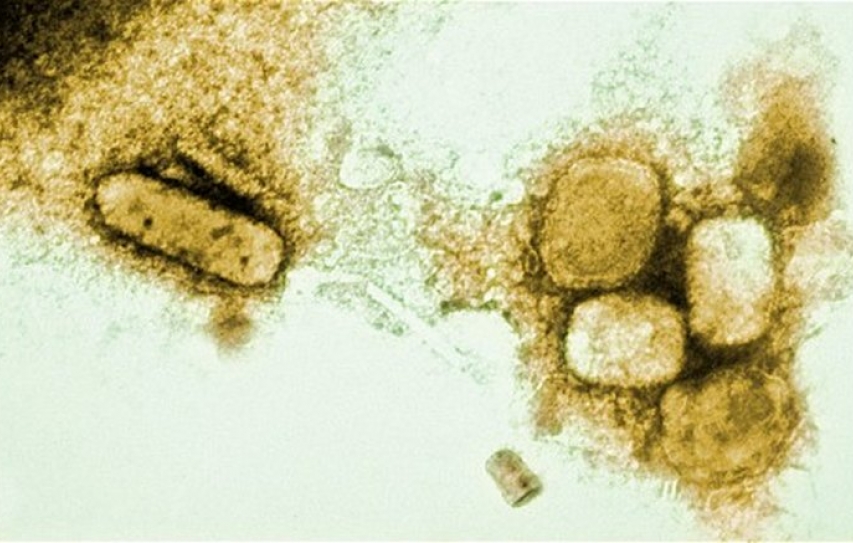 Smallpox, polio and HIV: the fights we’re winning against infectious disease
