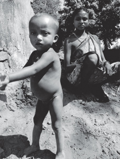 Treating Malnourished Children At Home Yields Better Results, Says Study