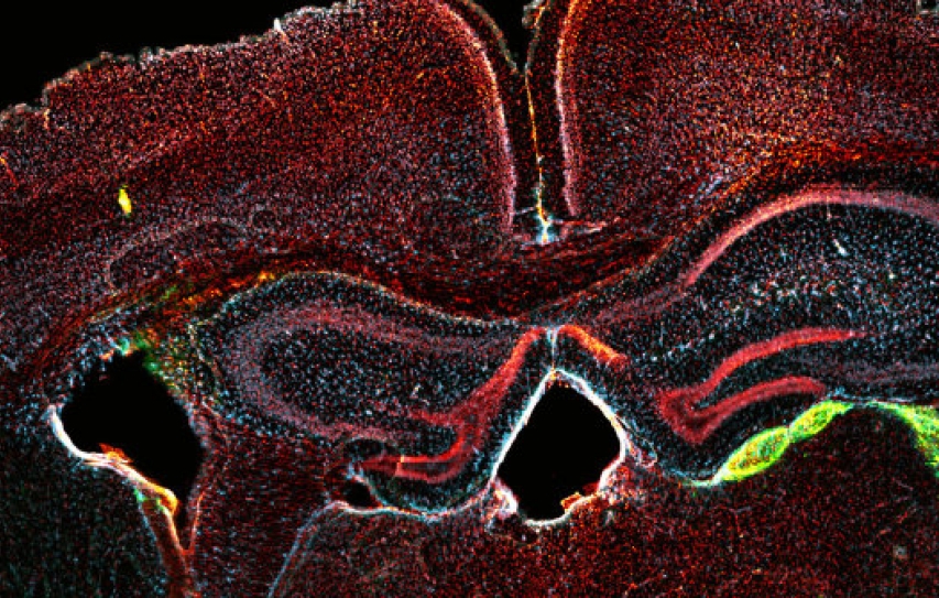 Scientists Can Now Transform Blood Cells Into Neurons