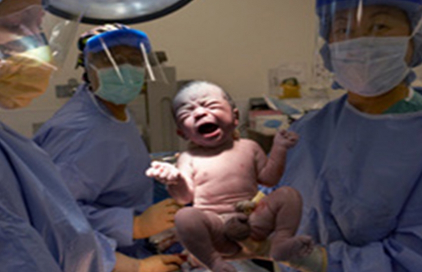 High Rate Of Maternal Mortality, C-Section Cause For Concern