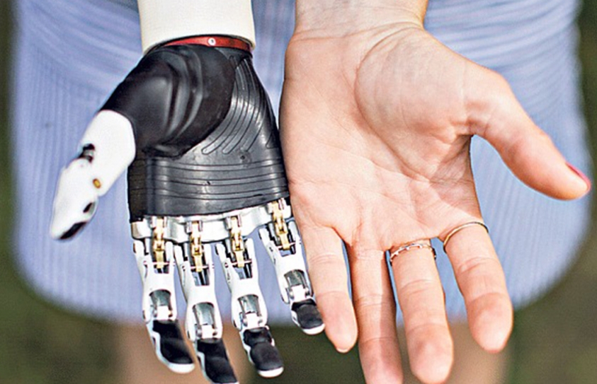 What It’s Like To Live With A Bionic Hand
