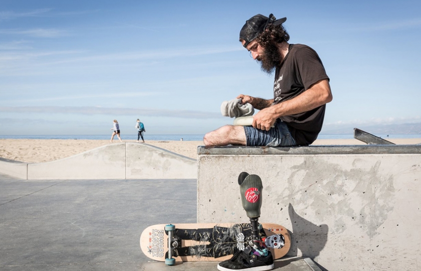 How One Skater Racked Up Thousands Of Miles On Four Wheels, Two Crutches & One Leg