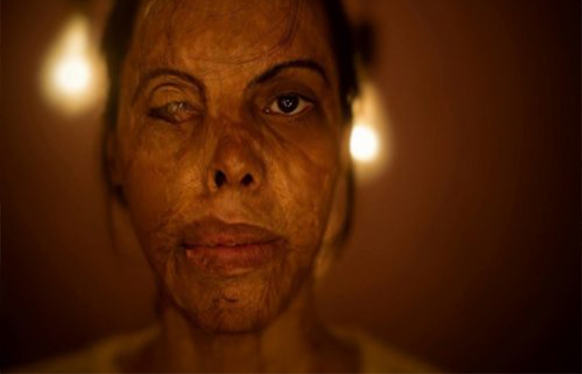 An Acid Attack Survivor’s Dream Of Owning A Salon’s Coming True Thanks To Miranda House Students