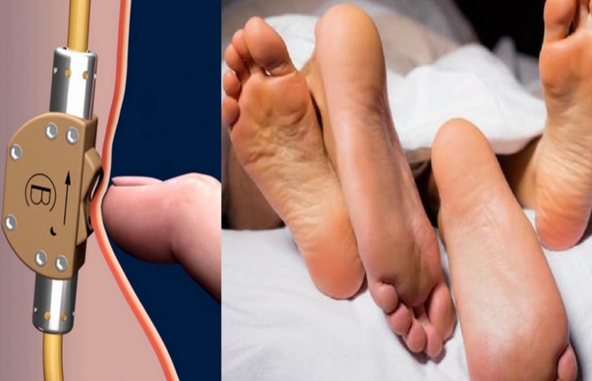 India- Bimek SLV - The Next Possible Male Contraceptive 