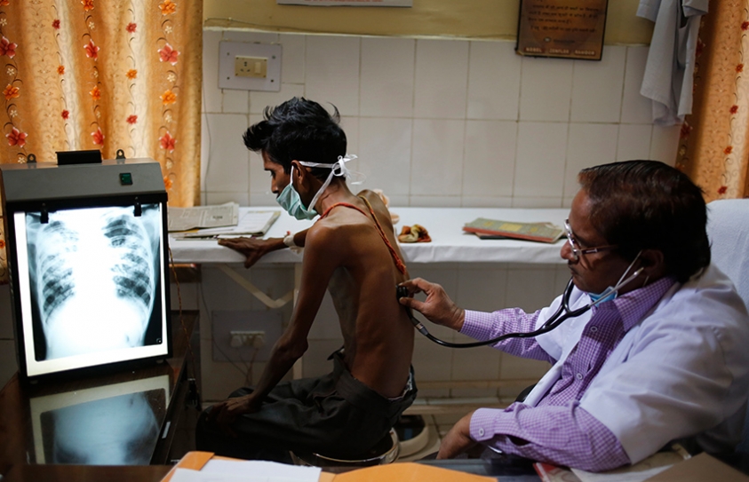 Multidrug-Resistant Tb Will Rise In India, Says New Study 